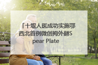 十堰人医成功实施鄂西北首例微创拇外翻Spear Plate髓内板矫形术