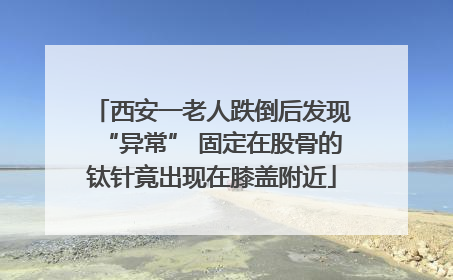西安一老人跌倒后发现“异常” 固定在股骨的钛针竟出现在膝盖附近